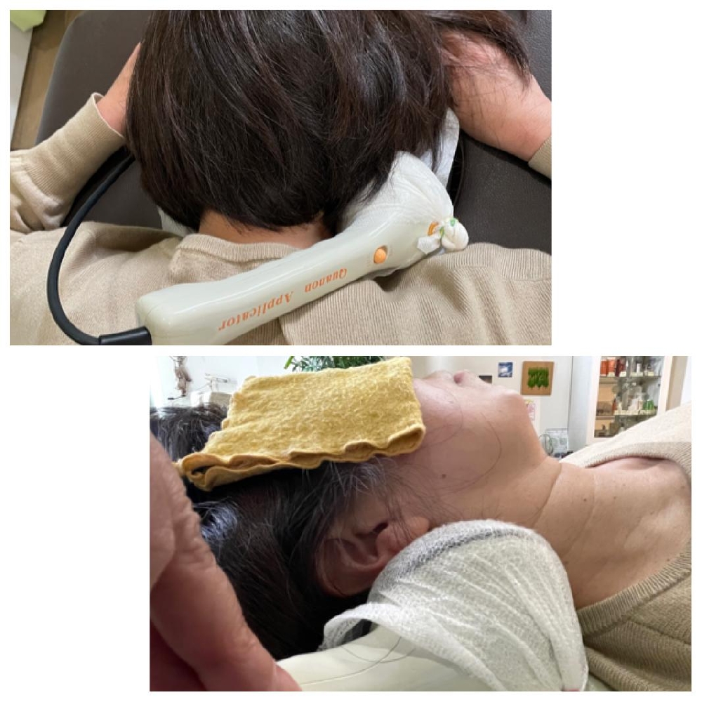 突発性難聴