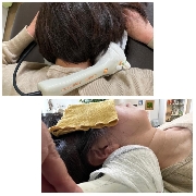 突発性難聴